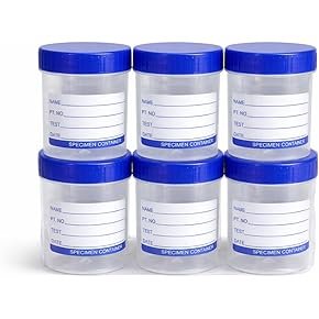 Urine & Sample Containers